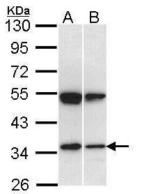 SH3GL1 antibody [N3C3]