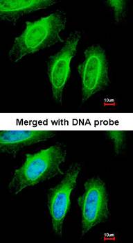 SH3GL1 antibody