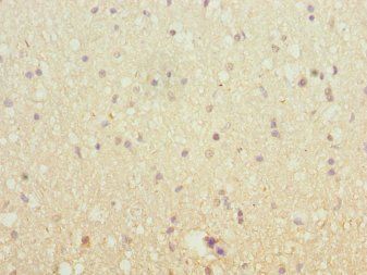 SH3GL2 Antibody