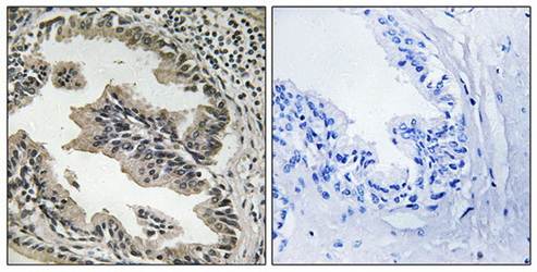 SH3GLB2 antibody