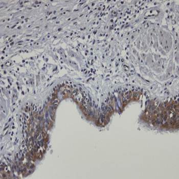 SH3KBP1 binding protein 1 antibody