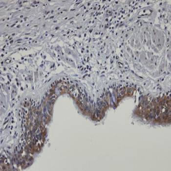 SH3KBP1 binding protein 1 antibody