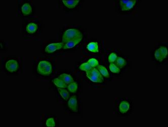 SH3TC2 Antibody