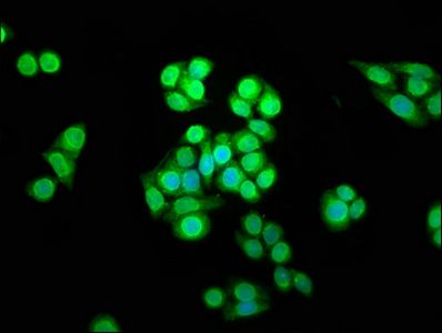 SHARPIN Antibody