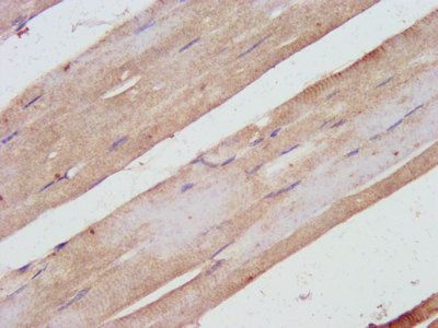 SHARPIN Antibody
