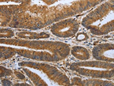 SHBG Antibody