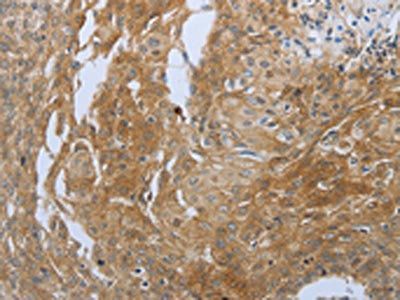 SHBG Antibody