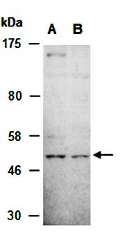 SHC1 (C2) Antibody, Rabbit Polyclonal