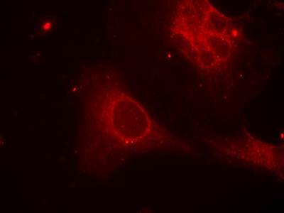 Shc1 (Phospho-Tyr349) Antibody