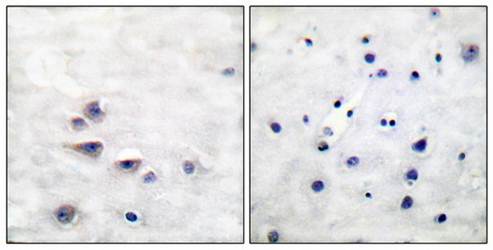 Shc (phospho-Tyr427) antibody