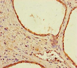 SHFM1 antibody