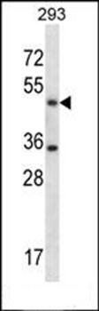 SHMT1 antibody