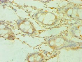 SHMT1 Antibody