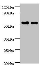 SHMT1 Antibody