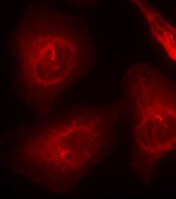 SHP-2 Rabbit Polyclonal Antibody