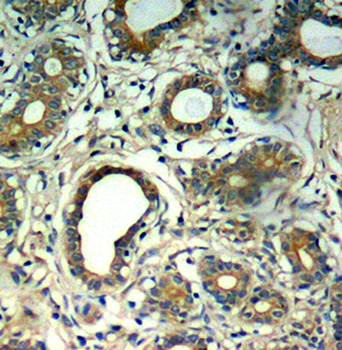 SHP-2 (Phospho-Tyr580) Antibody