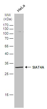 ST3 beta-galactoside alpha-2,3-sialyltransferase 1 Antibody