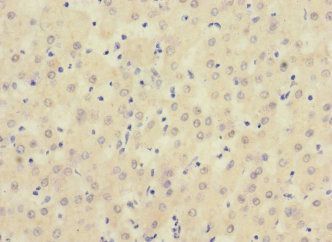 SIGIRR Antibody