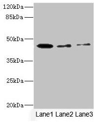 SIGIRR antibody