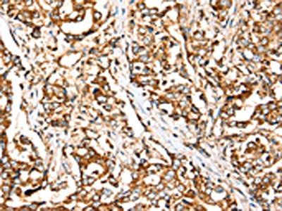 SIGLEC11 antibody