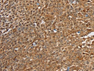 SIGLEC14 Antibody