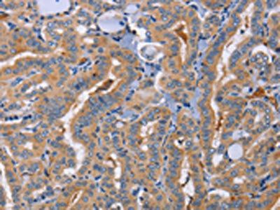 SIGLEC6 antibody