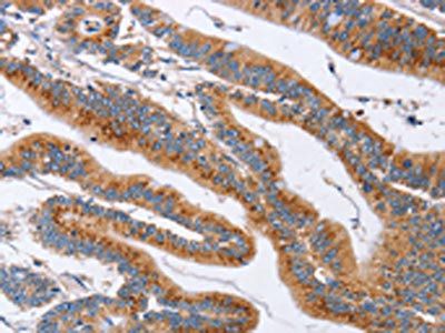 SIGLEC6 Antibody