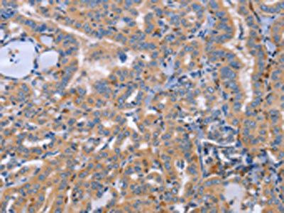 SIGLEC7 Antibody