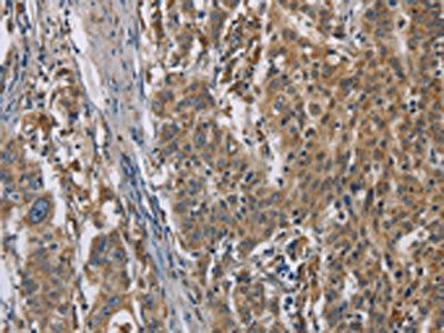 SIGMAR1 Antibody