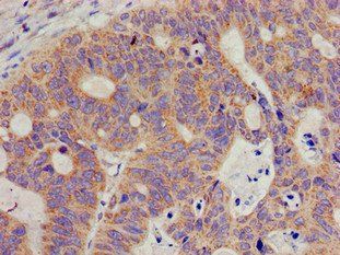 SIGMAR1 Antibody