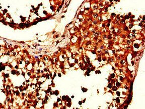 SIK1 Antibody