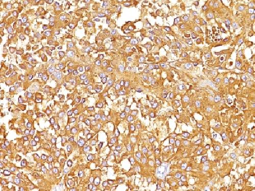 gp100 / Melanosome / PMEL17 / SILV (Melanoma Marker) Antibody