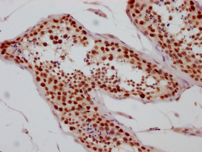 SIN3A Recombinant Monoclonal Antibody