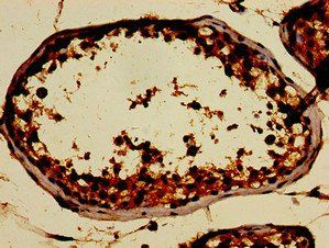 SIN3A antibody