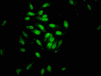 SIN3B Antibody