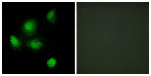 SIN3B Antibody