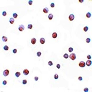 SIP1 Antibody