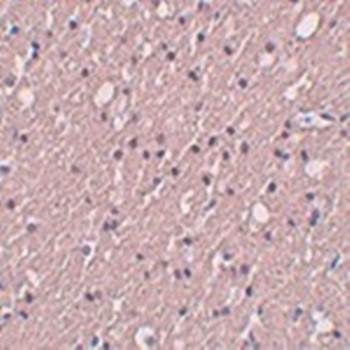 SIPA1L3 Antibody