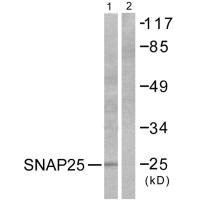 SIRPA antibody