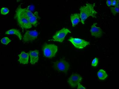 SIRPB1 Antibody