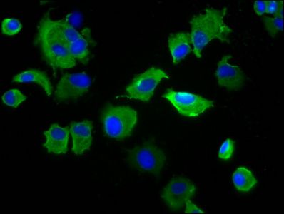 SIRPB1 antibody