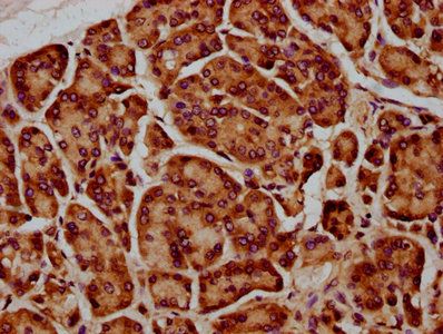 SIRPB1 Antibody