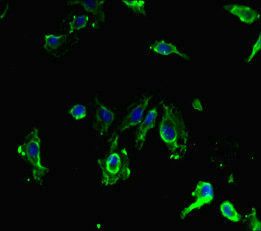 SIRPB1 antibody