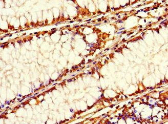 SIRPB1 Antibody