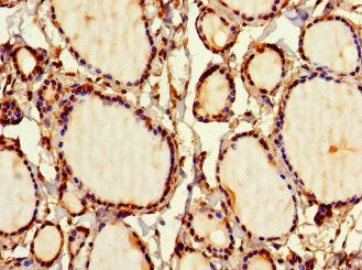 SIRPB1 Antibody