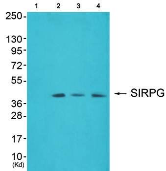 SIRPG Antibody