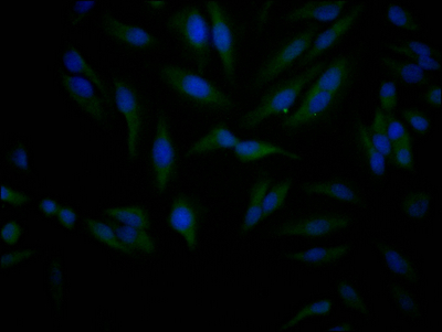 SIRT1 Recombinant Monoclonal Antibody