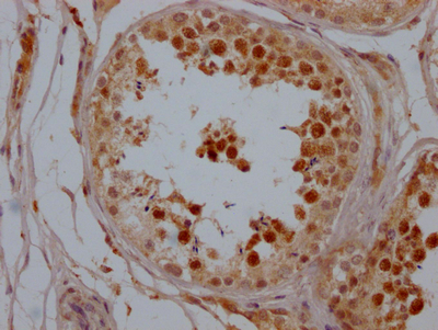 SIRT1 Recombinant Monoclonal Antibody