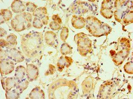 SIRT3 Antibody