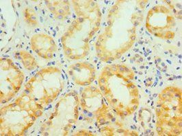 SIRT3 Antibody